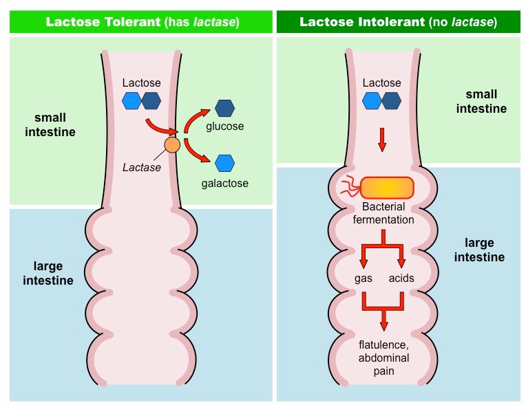 Lactose intolerance? What you need to know Ultimate Forces Challenge